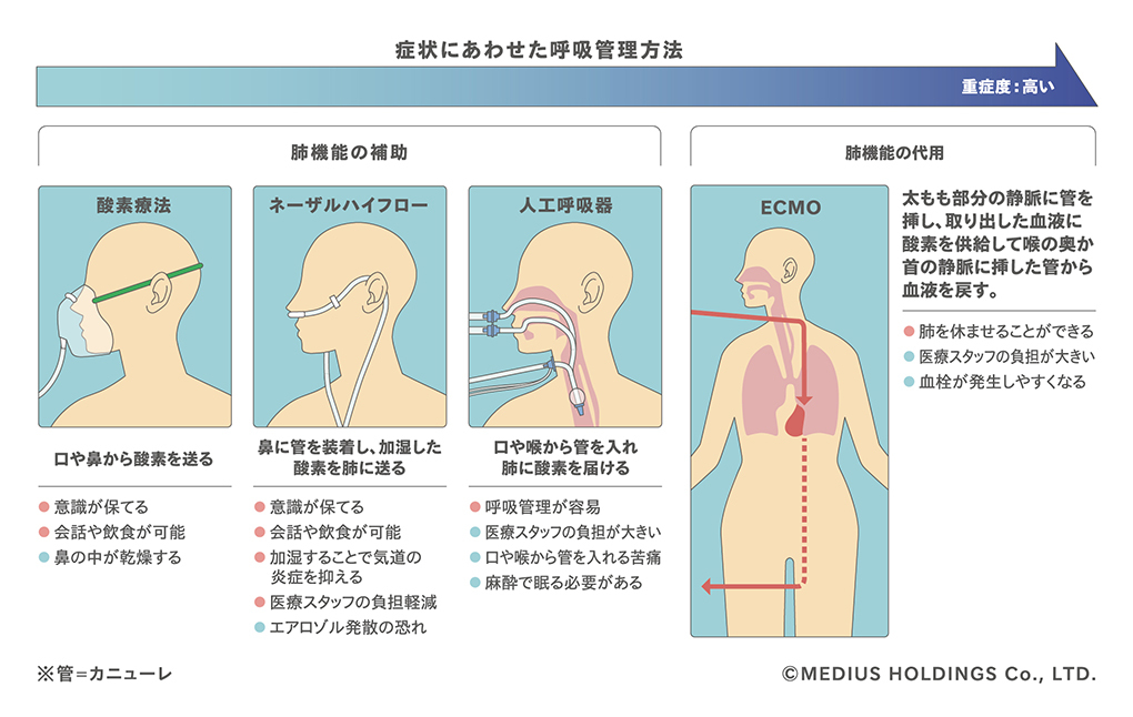 呼吸管理-