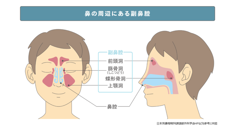 生活の質を低下させる副鼻腔炎 | メディアスホールディングス株式会社