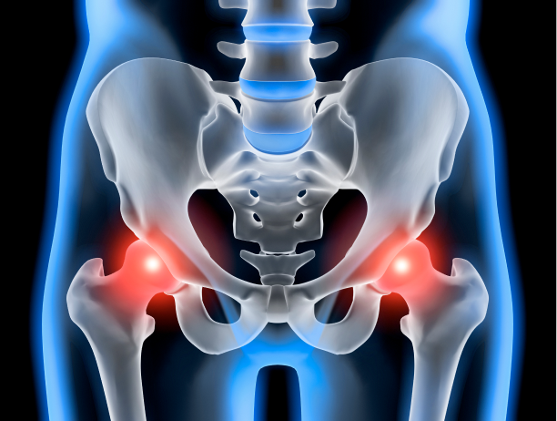 変形性股関節症の手術法（関節鏡視下手術、骨切り術、人工股関節置換術）とは