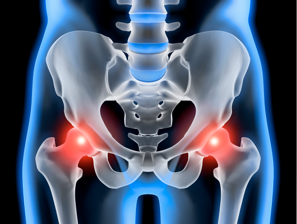 Surgical methods for hip osteoarthritis (arthroscopic surgery, osteotomy, total hip replacement)