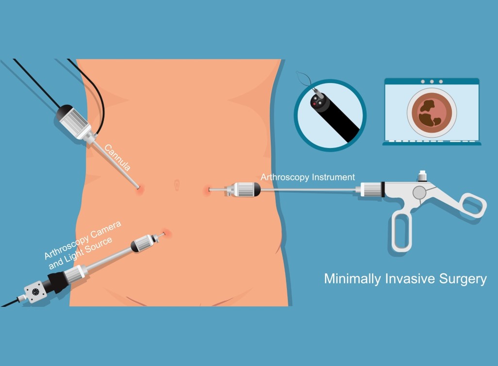 00d1d05c8b20a0a5599c10637e50a1